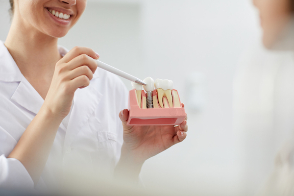 dental implants and dentures gordon