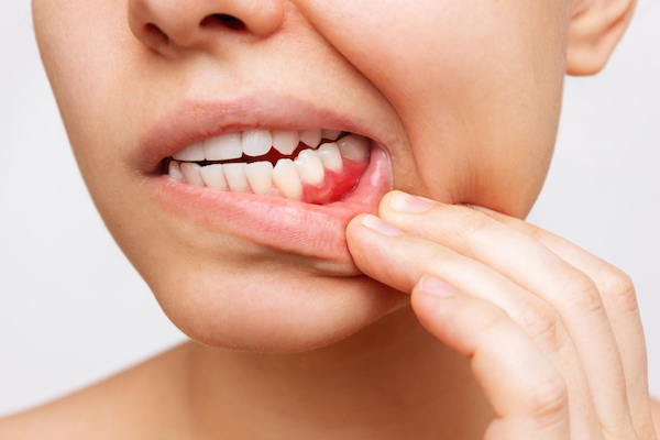 periodontal gum treatment gordon blurb