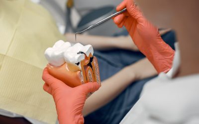 Root Canal Treatment – What to Expect
