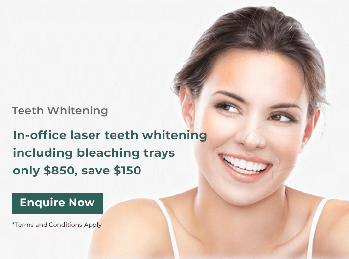in-office laser teeth whitening banner dentist gordon