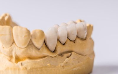 Dental Crowns vs Bridges: Comparing Different Restorative Options