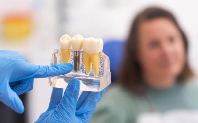 Are Dental Implants Right for You?