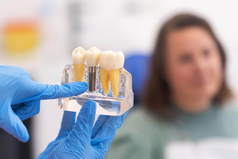 are dental implants right for you