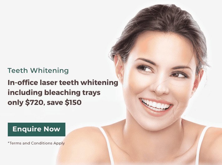 in office laser teeth whitening banner dentist gordon nsw 1