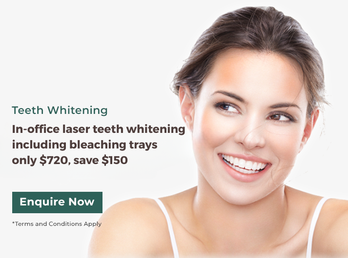 in-office laser teeth whitening banner dentist gordon