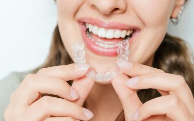 How Invisalign Straightens Teeth — and What to Expect
