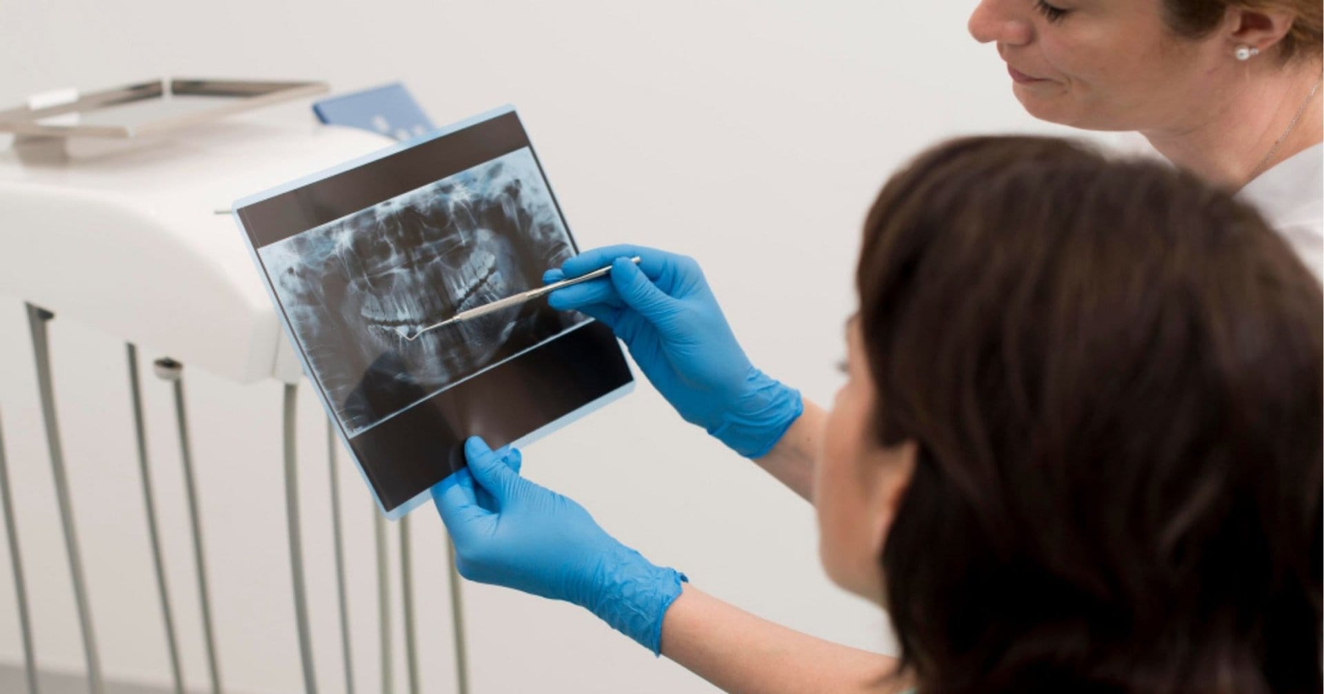 dental Xray being reviewed as part of a toothache assessment in Gordon
