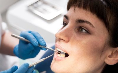 Tooth Decay: How It Is Treated at Each Stage