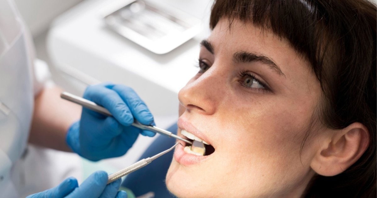 closeup of a dentist examining a patients teeth in Gordon