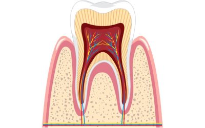 Enamel Hypoplasia: Why Some Teeth Have Thin or Patchy Enamel